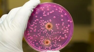 Παθολογική απόρριψη στους άνδρες όταν είναι ενθουσιασμένος